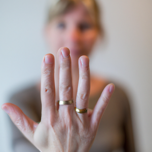 Spinner Rings and Dermatillomania